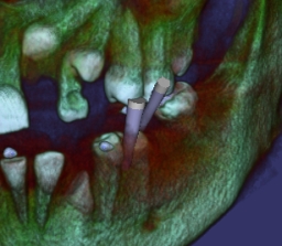 DentalViewer 3