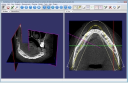 DentalViewer 1