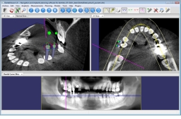 DentalViewer 3