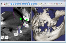 DentalViewer 4