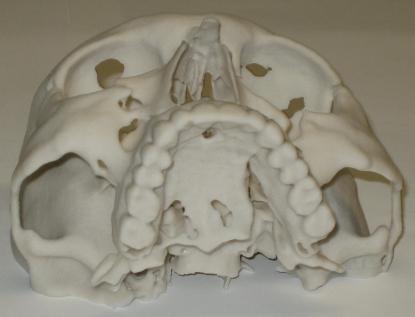 Real model of the human skull produced by Rapid Prototyping technology