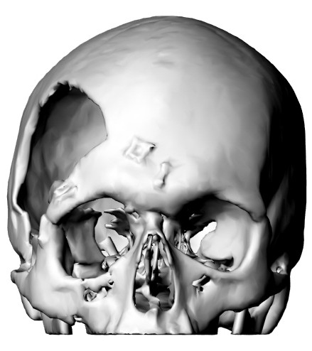 3D model of a human skull