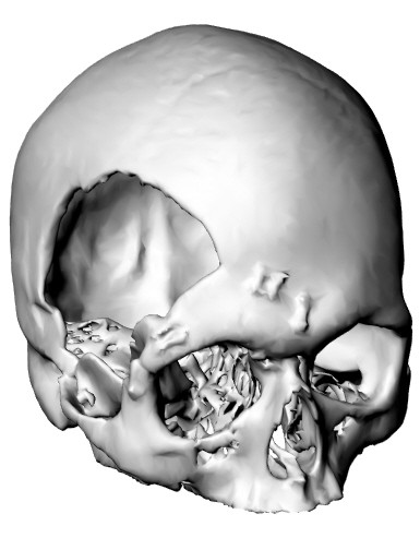 3D model of a human skull