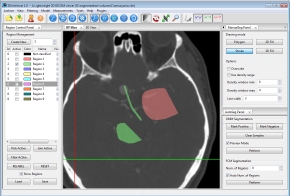 Segmentation Plugins